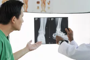 Semelles orthopédiques pour marcher avec une fracture du pied